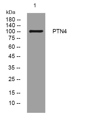 Western blot analysis of lysates from HepG2 cells, primary antibody was diluted at 1:1000, 4° overnight STJ195165