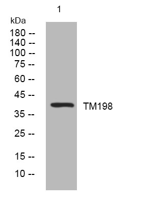 Western blot analysis of lysates from CACO2 cells, primary antibody was diluted at 1:1000, 4° overnight STJ195178