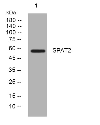 Western blot analysis of lysates from MCF-7 cells, primary antibody was diluted at 1:1000, 4°C overnight STJ195232