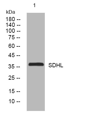Western blot analysis of lysates from HepG2 cells, primary antibody was diluted at 1:1000, 4° overnight STJ195455