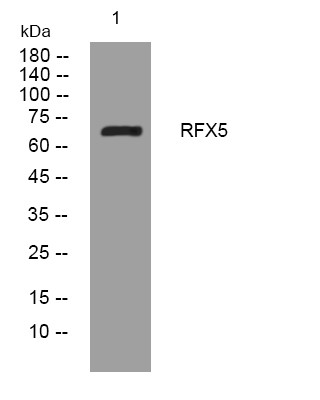 Western blot analysis of lysates from A431 cells, primary antibody was diluted at 1:1000, 4° overnight STJ195465
