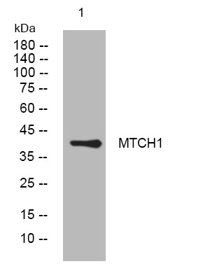 Western blot analysis of lysates from A431 cells, primary antibody was diluted at 1:1000, 4°C overnight STJ195522