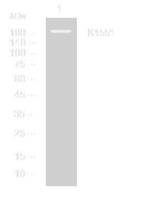 Western blot analysis of lysates from VEC cells, primary antibody was diluted at 1:1000, 4° overnight STJ195531
