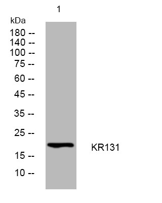 Western blot analysis of lysates from SW480 cells, primary antibody was diluted at 1:1000, 4°C overnight STJ195554