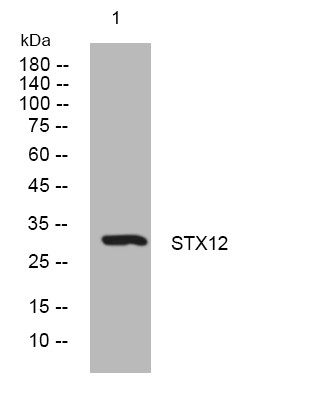 Western blot analysis of lysates from K562 cells, primary antibody was diluted at 1:1000, 4°C overnight STJ195577