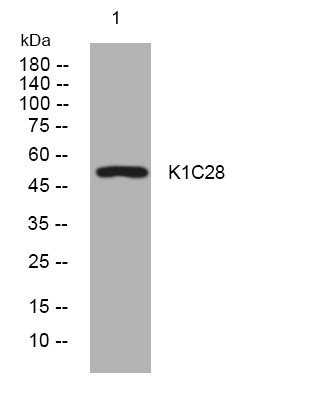 Western blot analysis of lysates from HeLa cells, primary antibody was diluted at 1:1000, 4° overnight STJ195622