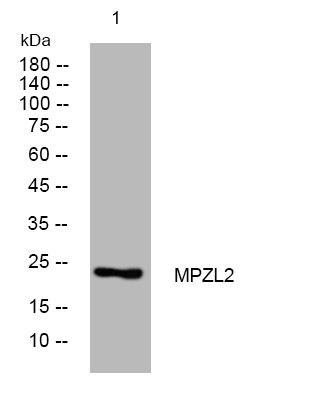 Western blot analysis of lysates from U2OS cells, primary antibody was diluted at 1:1000, 4°C overnight STJ195632