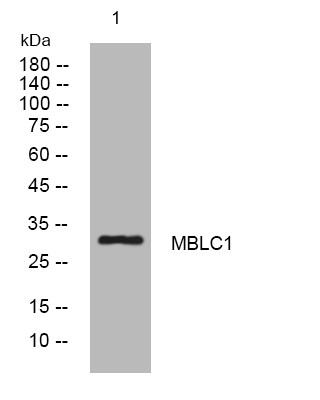 Western blot analysis of lysates from MCF-7 cells, primary antibody was diluted at 1:1000, 4° overnight STJ195685