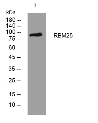 Western blot analysis of lysates from VEC cells, primary antibody was diluted at 1:1000, 4° overnight STJ195720