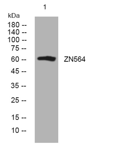 Western blot analysis of lysates from HpeG2 cells, primary antibody was diluted at 1:1000, 4°C over night
