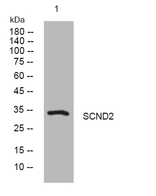 Western blot analysis of lysates from HeLa cells, primary antibody was diluted at 1:1000, 4° overnight STJ195815