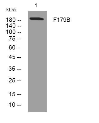Western blot analysis of lysates from MCF-7 cells, primary antibody was diluted at 1:1000, 4°C over night