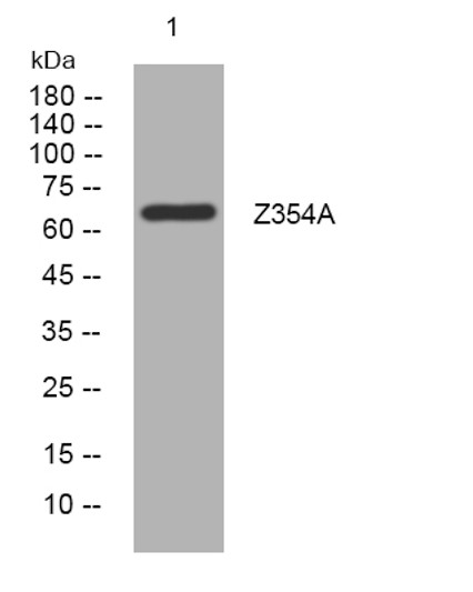 Western blot analysis of lysates from A431 cells, primary antibody was diluted at 1:1000, 4°C over night Western blot analysis of lysates from A431 cells, primary antibody was diluted at 1:1000, 4°C over night