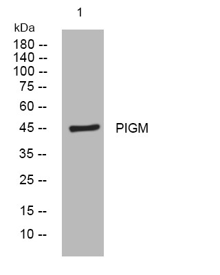Western blot analysis of lysates from A549 cells, primary antibody was diluted at 1:1000, 4° overnight STJ196005