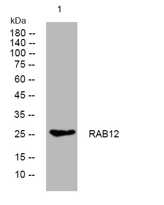 Western blot analysis of lysates from MDA-MB cells, primary antibody was diluted at 1:1000, 4°C overnight STJ196007