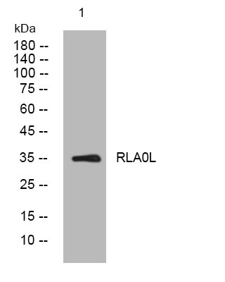 Western blot analysis of lysates from MDA-MB cells, primary antibody was diluted at 1:1000, 4° overnight STJ196009