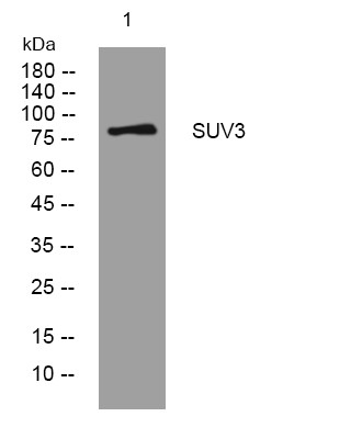 Western blot analysis of lysates from MDA-MB cells, primary antibody was diluted at 1:1000, 4° overnight STJ196031
