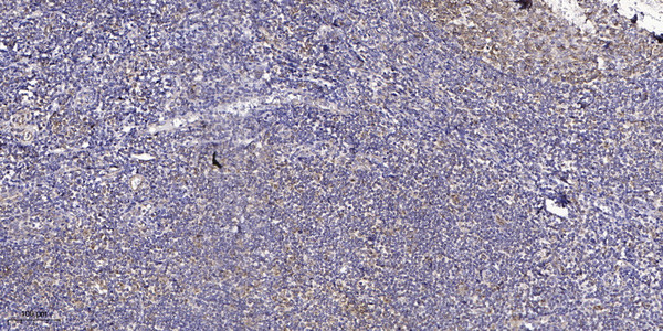 Immunohistochemical analysis of paraffin-embedded human tonsil. 1, Antibody was diluted at 1:200 (4°C overnight). 2, Tris-EDTA, pH9.0 was used for antigen retrieval. 3, Secondary antibody was diluted at 1:200 (room temperature, 45min).