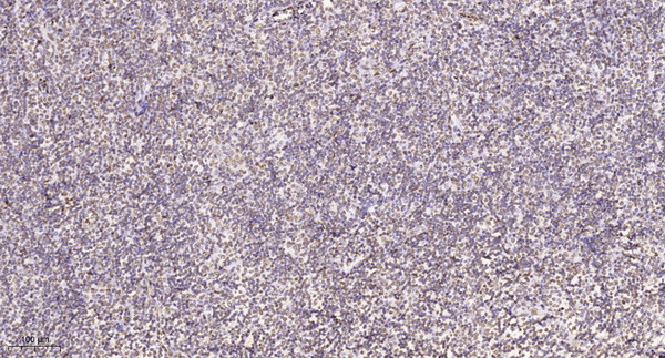 Immunohistochemical analysis of paraffin-embedded human tonsil. 1, Tris-EDTA, pH9.0 was used for antigen retrieval. 2 Antibody was diluted at 1:200 (4°C overnight. 3, Secondary antibody was diluted at 1:200 (room temperature, 45min).