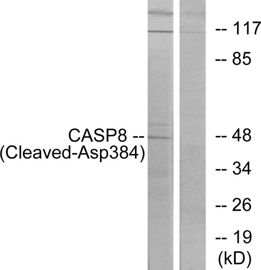 Western blot analysis of lysates from 293 cells, treated with etoposide 25uM 1h, using Caspase 8 (Cleaved-Asp384) Antibody. The lane on the right is blocked with the synthesized peptide.