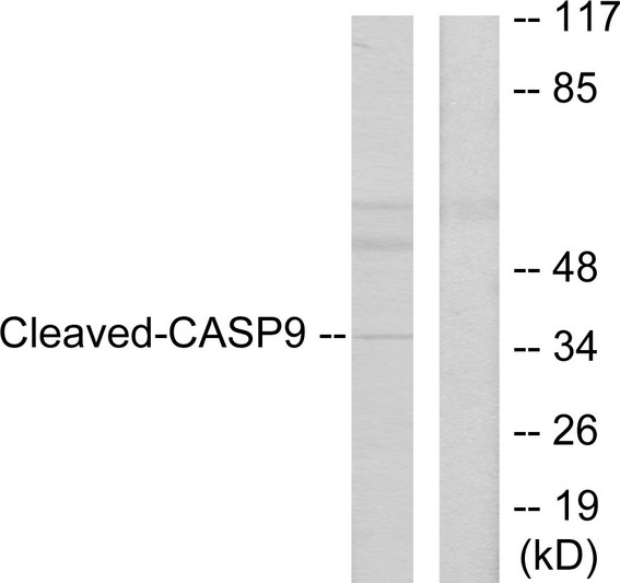 Western blot analysis of lysates from HeLa cells, treated with Etoposide 25uM 60', using Caspase 9 (Cleaved-Asp330) Antibody. The lane on the right is blocked with the synthesized peptide.
