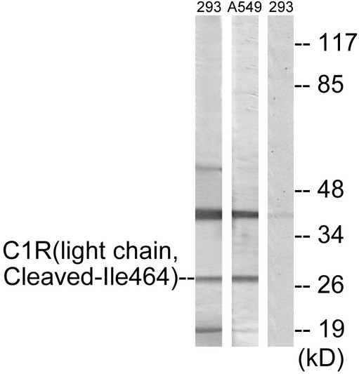 Western blot analysis of lysates from 293 and A549 cells, treated with etoposide 25uM 1h, using C1R (light chain, Cleaved-Ile464) Antibody. The lane on the right is blocked with the synthesized peptide.