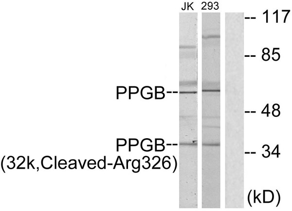 Western blot analysis of lysates from 293 and Jurkat cells, treated with etoposide 25uM 1h, using PPGB (32k, Cleaved-Arg326) Antibody. The lane on the right is blocked with the synthesized peptide.