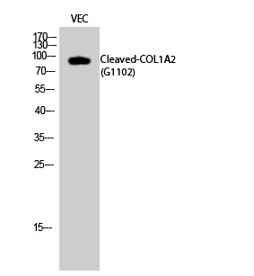 Western blot analysis of VEC cells using Cleaved-COL1A2 (G1102) Polyclonal Antibody diluted at 1：1000