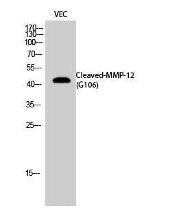 Western blot analysis of VEC cells using Cleaved-MMP-12 (G106) Polyclonal Antibody diluted at 1：1000