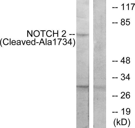 Western blot analysis of lysates from Jurkat cells, treated with etoposide 25uM 24h, using NOTCH2 (Cleaved-Ala1734) Antibody. The lane on the right is blocked with the synthesized peptide.