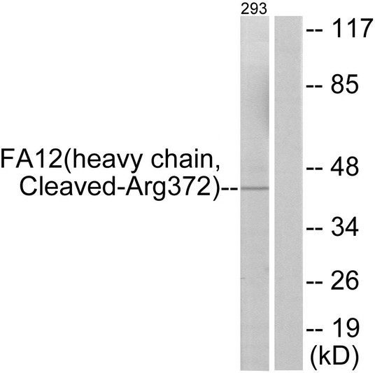 Western blot analysis of lysates from 293 cells, treated with etoposide 25uM 1h, using FA12 (heavy chain, Cleaved-Arg372) Antibody. The lane on the right is blocked with the synthesized peptide. Western blot analysis of lysates from 293 cells, treated with etoposide 25uM 1h, using FA12 (heavy chain, Cleaved-Arg372) Antibody. The lane on the right is blocked with the synthesized peptide.