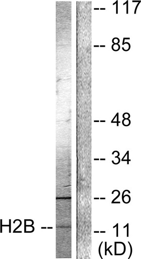 Western blot analysis of lysates from Raw264.7 cells, treated with TSA 400nM 24h, using Histone H2B (Acetyl-Lys15) Antibody. The lane on the right is blocked with the synthesized peptide.