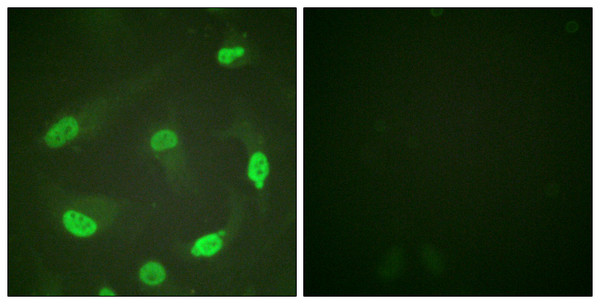 Immunofluorescence analysis of HeLa cells, using p53 (Acetyl-Lys379) Antibody. The picture on the right is blocked with the synthesized peptide.