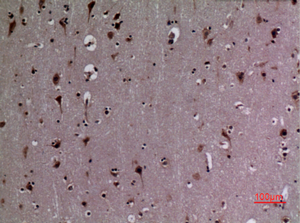 Immunohistochemical analysis of paraffin-embedded human-brain, antibody was diluted at 1:100
