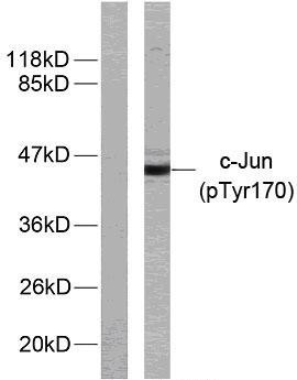 Western blot analysis of lysates from HeLa cells treated with UV, using c-Jun (Phospho-Tyr170) Antibody. The lane on STJ90178