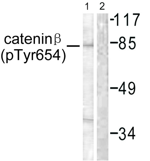 Western blot analysis of lysates from 293 cells, using Catenin-beta (Phospho-Tyr654) Antibody. The lane on the right is blocked with the phospho peptide.