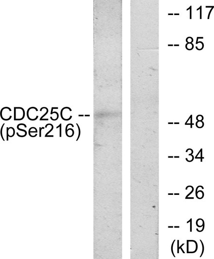 Western blot analysis of lysates from HUVEC cells treated with serum 20% 30', using CDC25C (Phospho-Ser216) Antibody. The lane on the right is blocked with the phospho peptide.
