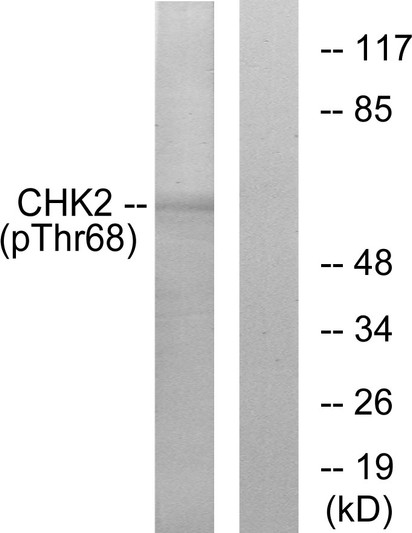 Western blot analysis of lysates from Jurkat cells treated with UV, using Chk2 (Phospho-Thr68) Antibody. The lane on the right is blocked with the phospho peptide.