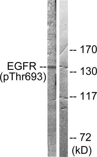 Western blot analysis of lysates from A431 cells, using EGFR (Phospho-Thr693) Antibody. The lane on the right is blocked with the phospho peptide.