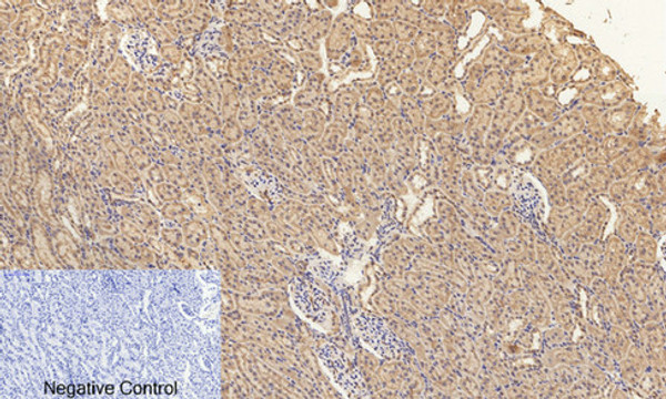 Immunohistochemical analysis of paraffin-embedded Rat-kidney tissue. 1, ERK 1/2 (phospho Thr202) Polyclonal Antibody was diluted at 1:200 (4°C, overnight). 2, Sodium citrate pH 6.0 was used for antibody retrieval (>98°C, 20min). 3, Secondary antibody was diluted at 1:200 (room tempeRature, 30min). Negative control was used by secondary antibody only. Immunohistochemical analysis of paraffin-embedded Rat-kidney tissue. 1, ERK 1/2 (phospho Thr202) Polyclonal Antibody was diluted at 1:200 (4°C, overnight). 2, Sodium citrate pH 6.0 was used for antibody retrieval (>98°C, 20min). 3, Secondary antibody was diluted at 1:200 (room tempeRature, 30min). Negative control was used by secondary antibody only.