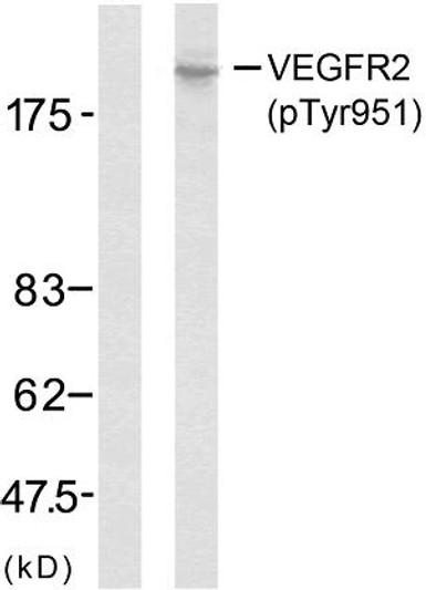 Western blot analysis of lysates from SK-OV3 cells, using VEGFR2 (Phospho-Tyr951) Antibody. The lane on the left is blocked with the phospho peptide.