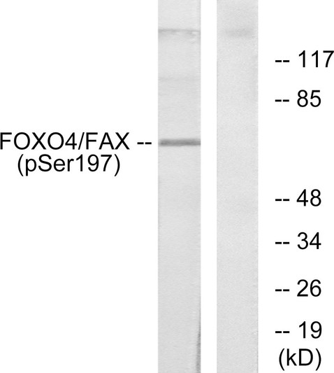 Western blot analysis of lysates from 293 cells treated with serum, using AFX (Phospho-Ser197) Antibody. The lane on the right is blocked with the phospho peptide.