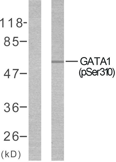 Western blot analysis of lysates from COS7 cells treated with EPO, using GATA1 (Phospho-Ser310) Antibody. The lane on the left is blocked with the phospho peptide.