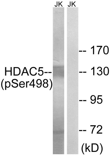 Western blot analysis of lysates from Jurkat cells, using HDAC5 (Phospho-Ser498) Antibody. The lane on the right is blocked with the phospho peptide.