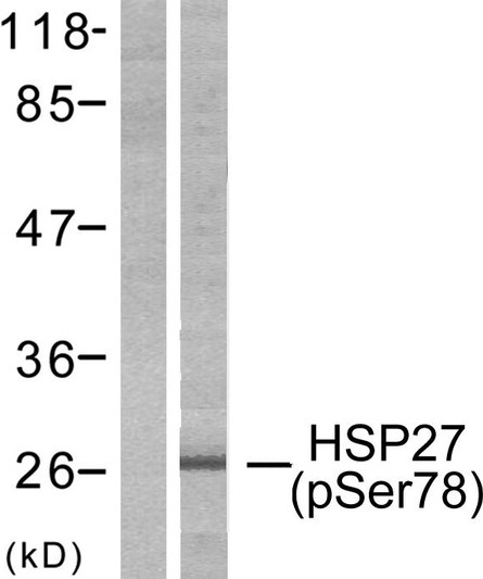 Western blot analysis of lysates from HeLa cells treated with Ca2+, using HSP27 (Phospho-Ser78) Antibody. The lane on the left is blocked with the phospho peptide.