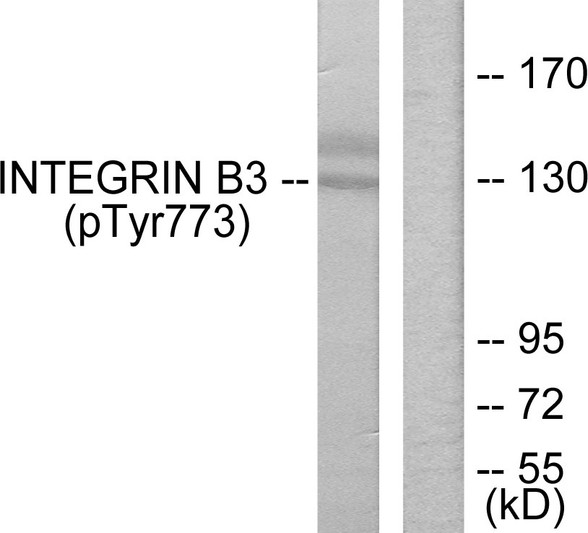 Western blot analysis of lysates from HL-60 cells treated with H2O2, using Integrin beta3 (Phospho-Tyr773) Antibody. The lane on the right is blocked with the phospho peptide.