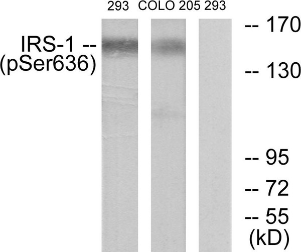 Western blot analysis of lysates from 293 cells and COLO205 cells, using IRS-1 (Phospho-Ser636) Antibody. The lane on the right is blocked with the phospho peptide.