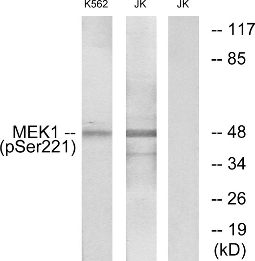Western blot analysis of lysates from K562 cells treated with serum 20% 15' and Jurkat cells treated with EGF, using MEK1/2 (Phospho-Ser221) Antibody. The lane on the right is blocked with the phospho peptide.
