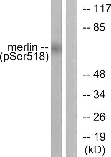 Western blot analysis of lysates from HUVEC cells treated with IFN-alpha 1000U/ml 18h, using Merlin (Phospho-Ser518) Antibody. The lane on the right is blocked with the phospho peptide.