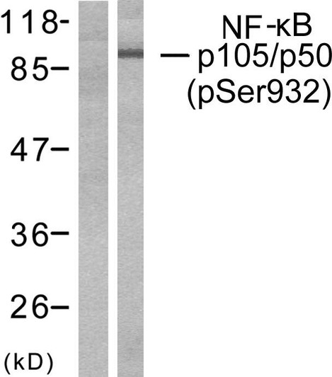 Western blot analysis of lysates from HeLa cells treated with CA+TNF 20ng/ml 10', using NF-kappaB p105/p50 (Phospho-Ser932) Antibody. The lane on the left is blocked with the phospho peptide.